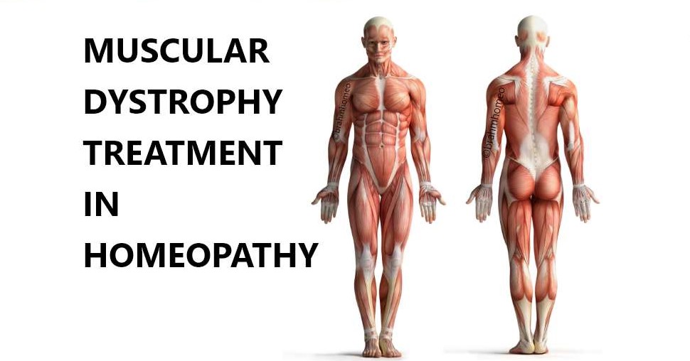 Homeopathy for Muscular Dystrophy